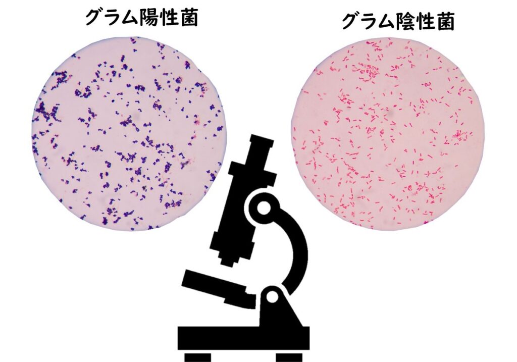 この感染症の症状は何ですか?