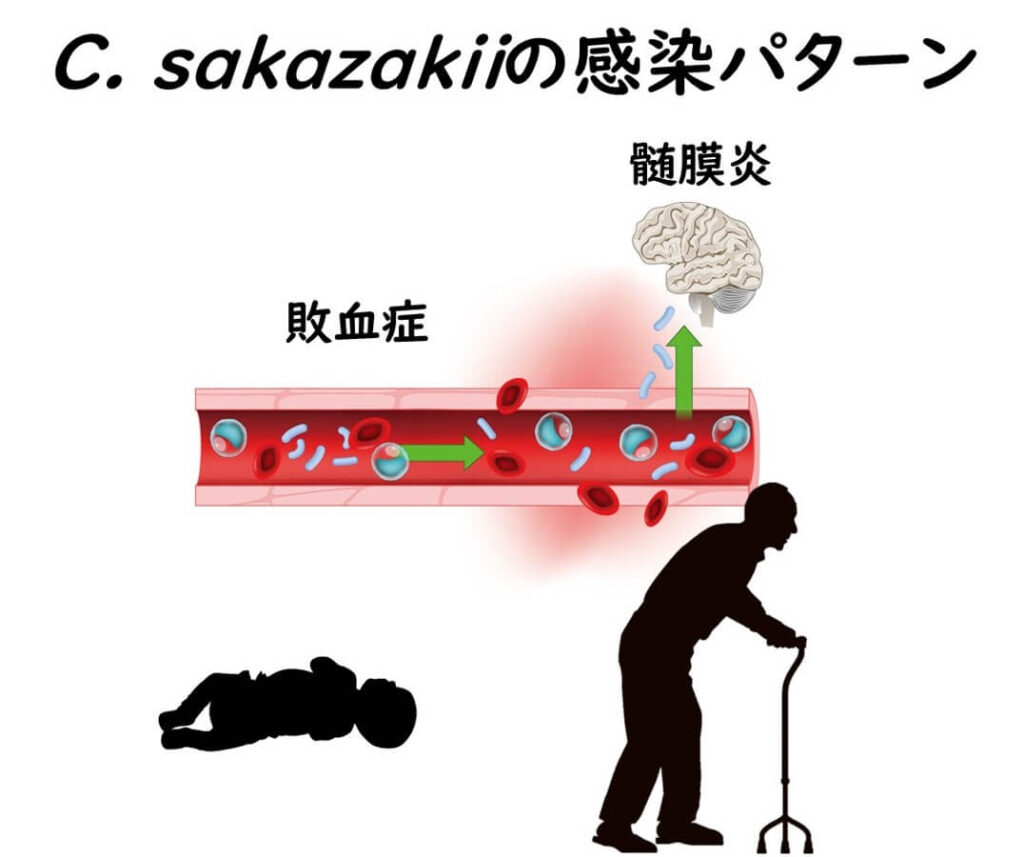 Cronobacter sakazakiiによる感染パターン