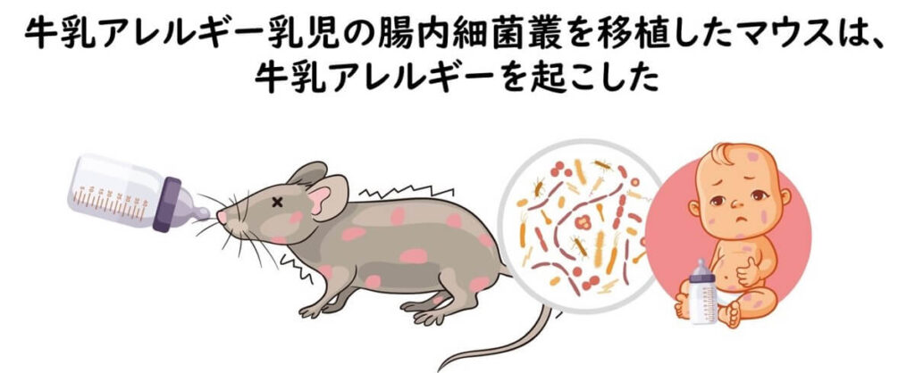 牛乳アレルギー乳児の腸内細菌叢を移植したマウスは、牛乳アレルギーを起こした