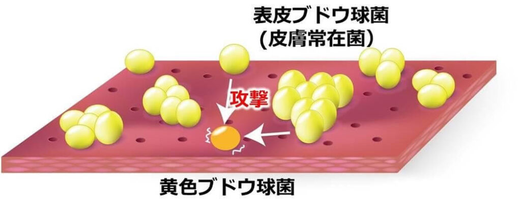 皮膚の表面で黄色ブドウ球菌を攻撃する常在菌