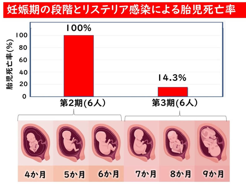 妊娠期の段階とリステリア感染による胎児死亡率の関係。