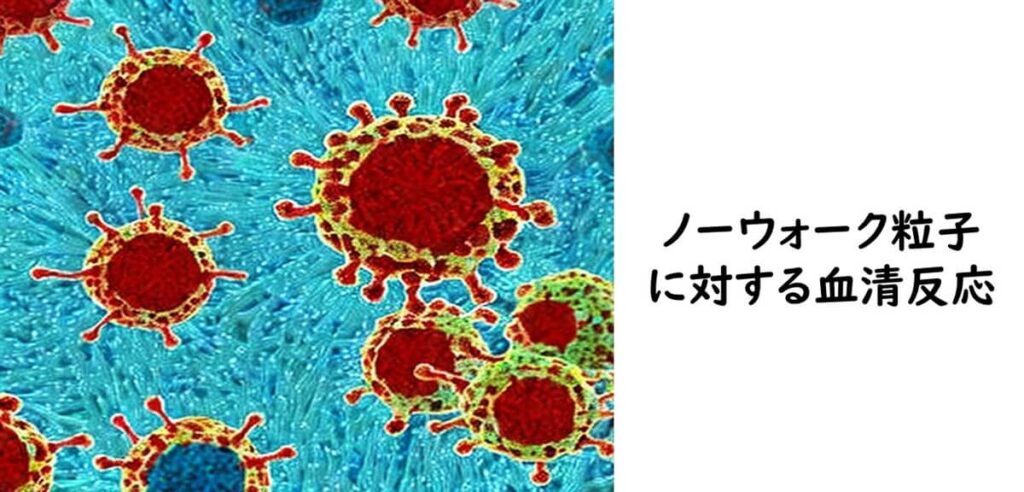 免疫電子顕微鏡でウィルス粒子を血清反応を行った