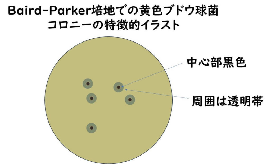 Baird-Parker培地の典型コロニー