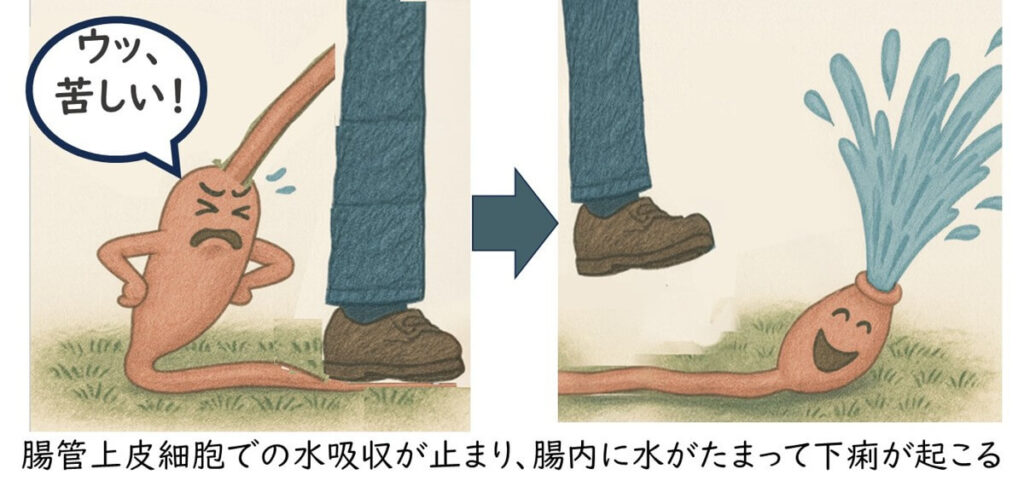 腸管上皮細胞で水分吸収が止まり、腸内に水がたまって下痢が起こる様子をホースで表現したイラスト。EAEC感染による水様性下痢の発症メカニズムをわかりやすく示している。