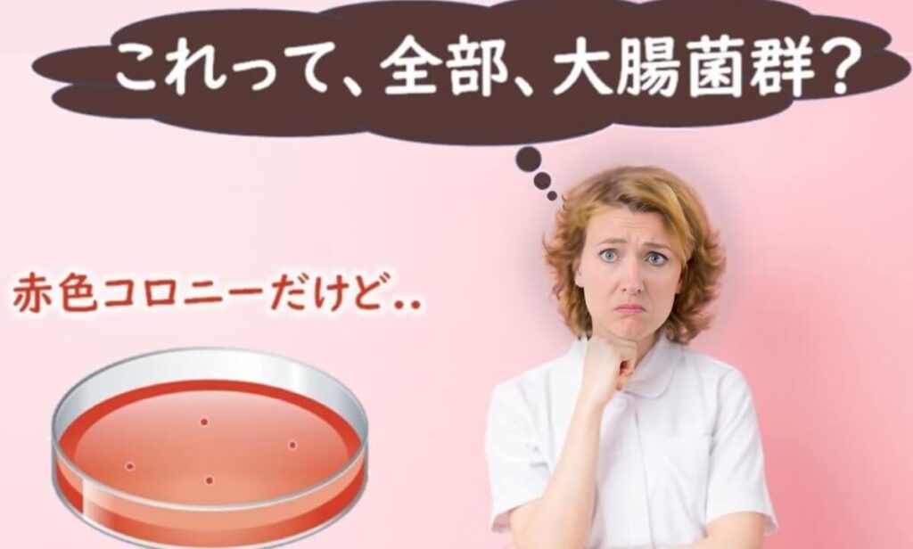  「これって全部大腸菌群？」と悩む女性品質管理担当者のイラスト。


